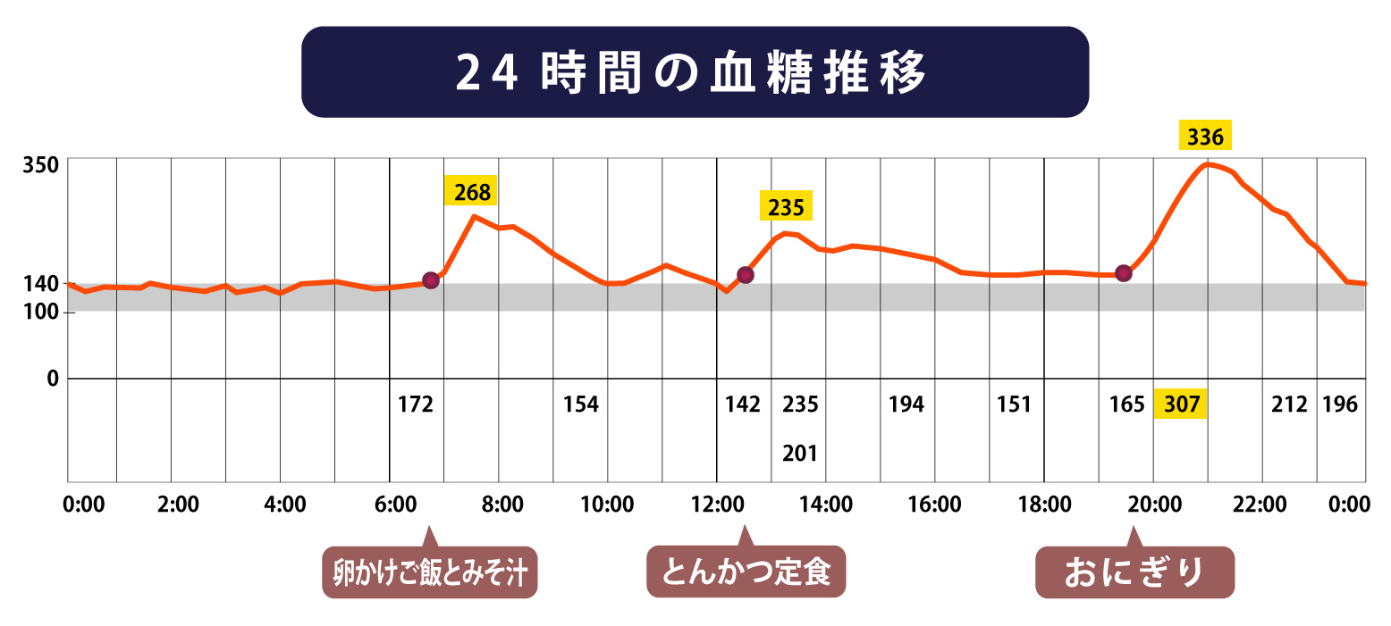 24時間血糖グラフ